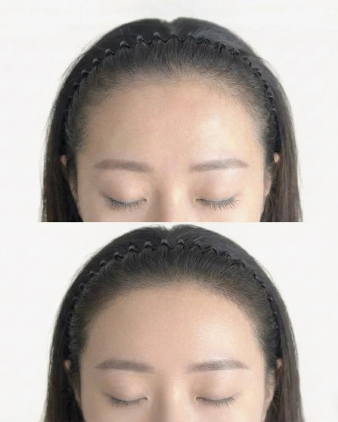 Hairline